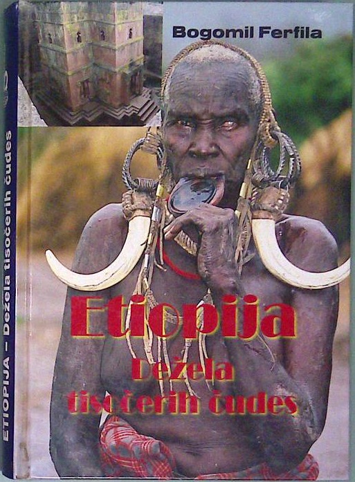 Etiopija